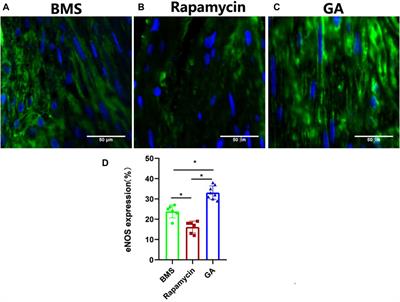 A novel glycyrrhizin acid-coated stent reduces neointimal formation in a rabbit iliac artery model